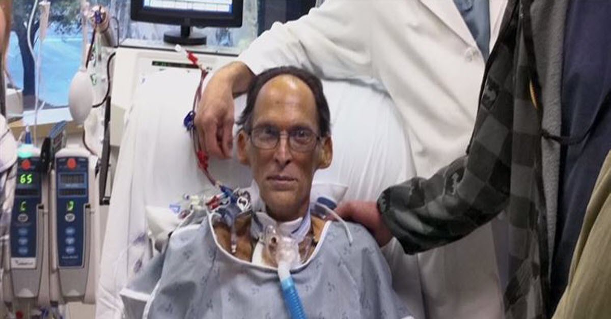 Meet The Very First Man Without A Heart Who Is Able To Live Without A Pulse